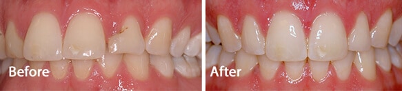 Shine Dental Care Nottinghamshire