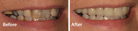 Teeth transformation results